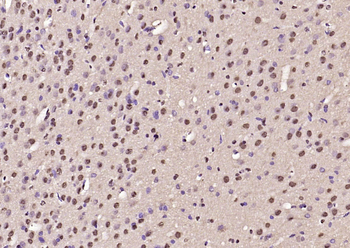 BRD1 Rabbit Polyclonal Antibody