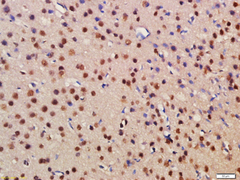BRD1 Rabbit Polyclonal Antibody