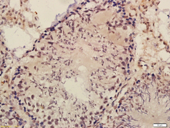 BRD1 Rabbit Polyclonal Antibody