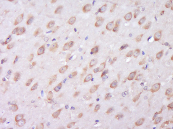 BRPF3 Rabbit Polyclonal Antibody