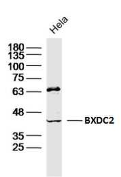 BXDC2 Rabbit Polyclonal Antibody