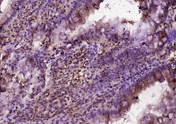 BTBD7 Rabbit Polyclonal Antibody