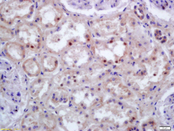 HOXC9 Rabbit Polyclonal Antibody
