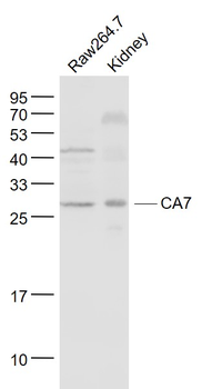 CA7 Rabbit Polyclonal Antibody