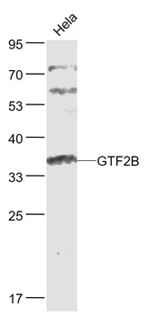 GTF2B Rabbit Polyclonal Antibody