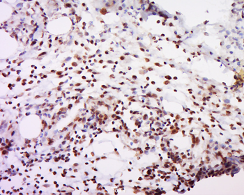 FAM113A Rabbit Polyclonal Antibody