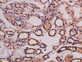 ABI3 Rabbit Polyclonal Antibody