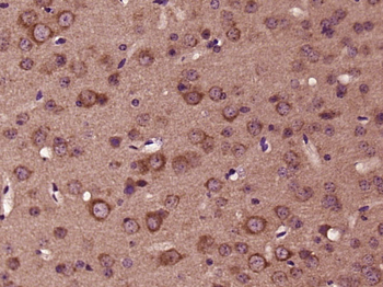 AMPK beta 2 Rabbit Polyclonal Antibody