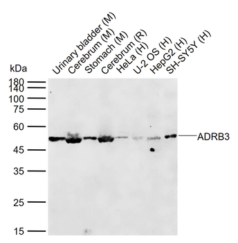 ADRB3 Rabbit Polyclonal Antibody