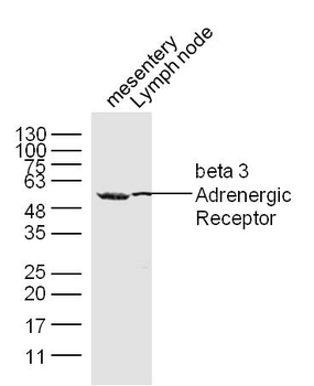ADRB3 Rabbit Polyclonal Antibody