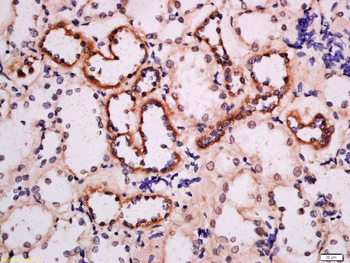 ADRB3 Rabbit Polyclonal Antibody