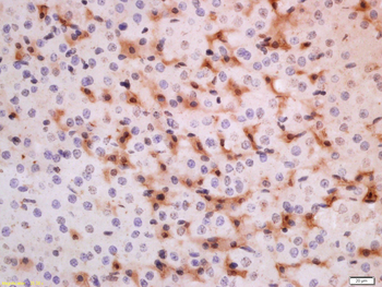 ADRB3 Rabbit Polyclonal Antibody