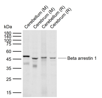 Beta arrestin 1 Rabbit Polyclonal Antibody