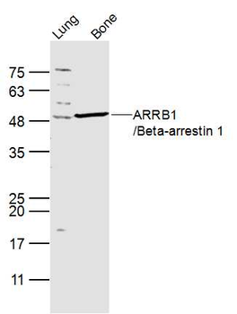 Beta arrestin 1 Rabbit Polyclonal Antibody