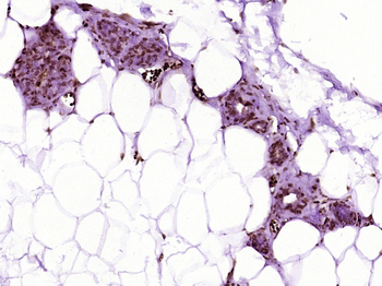 BarX2 Rabbit Polyclonal Antibody