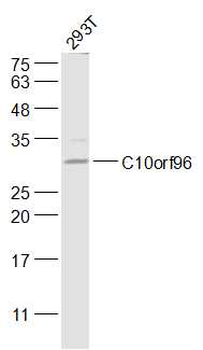 C10orf96 Rabbit Polyclonal Antibody