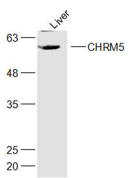 CHRM5 Rabbit Polyclonal Antibody