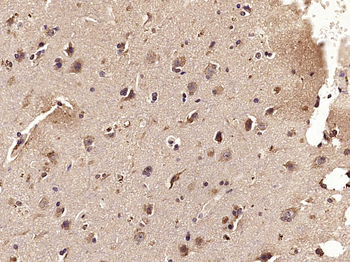 CCL2 Rabbit Polyclonal Antibody