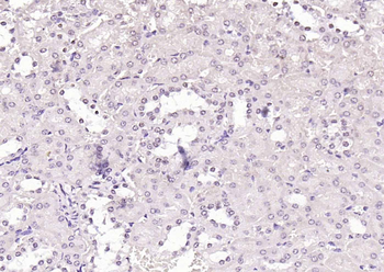 Phospho-CDK9 (Thr29) Rabbit Polyclonal Antibody