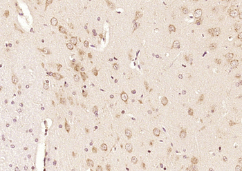 CRF1 Rabbit Polyclonal Antibody