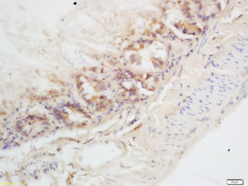 CHKL Rabbit Polyclonal Antibody