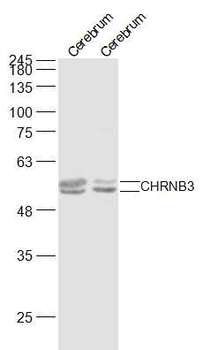 CHRNB3 Rabbit Polyclonal Antibody