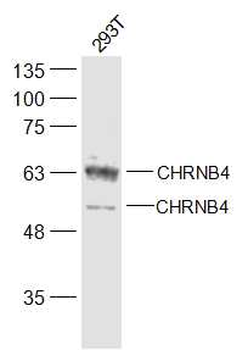 CHRNB4 Rabbit Polyclonal Antibody