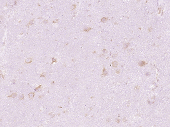 DHRS11 Rabbit Polyclonal Antibody