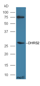 DHRS2 Rabbit Polyclonal Antibody