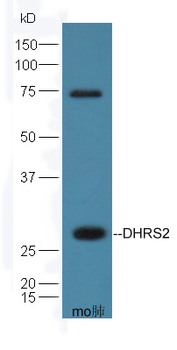 DHRS2 Rabbit Polyclonal Antibody
