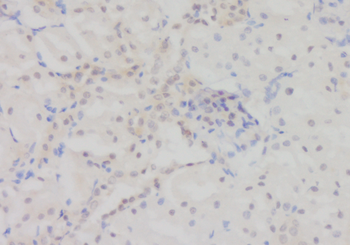 DHRS2 Rabbit Polyclonal Antibody
