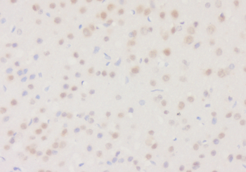 DHRS2 Rabbit Polyclonal Antibody