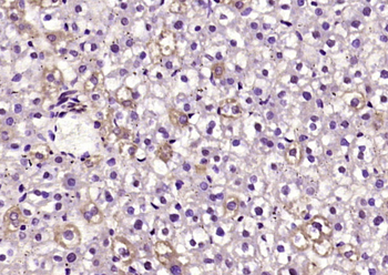 DCP1A Rabbit Polyclonal Antibody