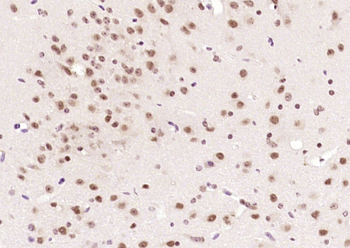 ER81 Rabbit Polyclonal Antibody
