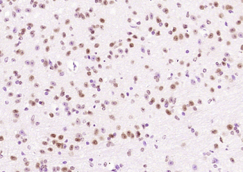 ER81 Rabbit Polyclonal Antibody