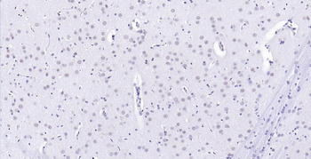 ER81 Rabbit Polyclonal Antibody