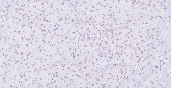 ER81 Rabbit Polyclonal Antibody