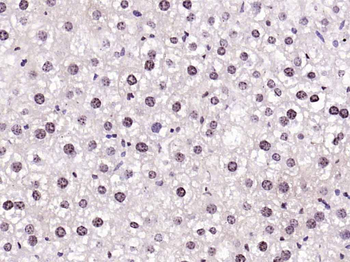 FAM13C1 Rabbit Polyclonal Antibody
