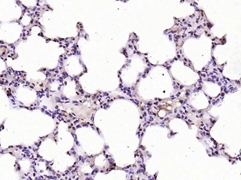 FAM13C1 Rabbit Polyclonal Antibody