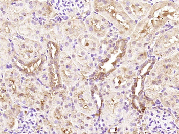 EDC4 Rabbit Polyclonal Antibody
