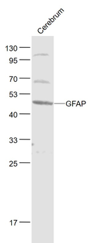 GFAP Rabbit Polyclonal Antibody
