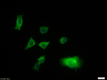GFAP Rabbit Polyclonal Antibody