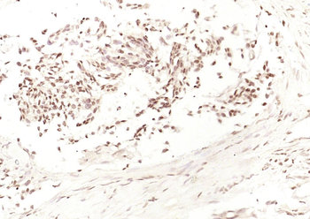 HDGF Rabbit Polyclonal Antibody