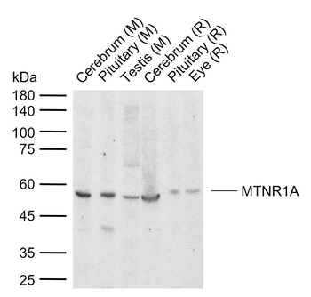 MTNR1A Rabbit Polyclonal Antibody