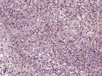 MLH3 Rabbit Polyclonal Antibody