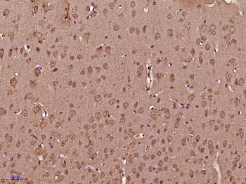 MLK2/MAP3K10 Rabbit Polyclonal Antibody
