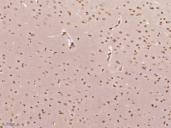 MONDOA Rabbit Polyclonal Antibody