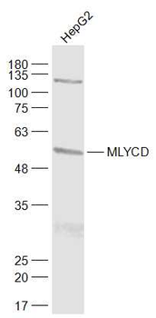 MLYCD Rabbit Polyclonal Antibody
