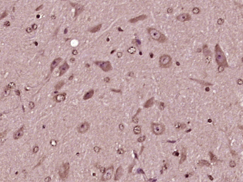 MZT1 Rabbit Polyclonal Antibody