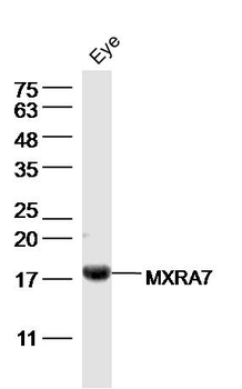 MXRA7 Rabbit Polyclonal Antibody